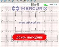 Программное обеспечение для анализа