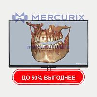 Модуль программного обеспечения для визуализации DICOM Ceramill Dicom-Viewer
