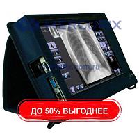 Система сбора данных для медицинских изображений для радиографии Primo W add-on