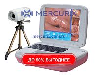 Видеокольпоскоп AD-2000Y 