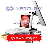 Эндоскопическая стойка для эндоскопической нейрохирургии 1080P