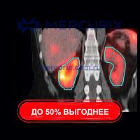 Программное обеспечение для анализа MIM SurePlan™ MRT