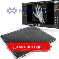 Плоскопанельный детектор для многофункциональной радиографии TeseoX