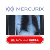 Негатоскоп 1 диапазон
