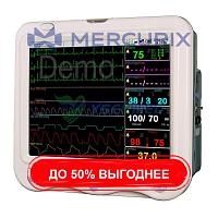 Компактный многопараметрический монитор пациента YSF15