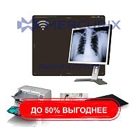 Система сбора данных для медицинских изображений для радиографии Retro Print Pro