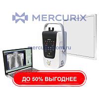 Портативные рентгенографические системы