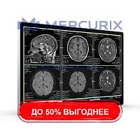 Монитор для медицинских снимков UHD Surgical Monitor