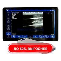 Портативный ультразвуковой сканер WU9 series