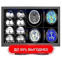 Монитор для медицинских снимков MD42CA
