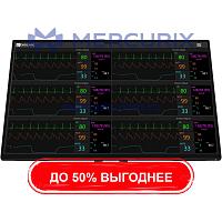 Система наблюдения пациент